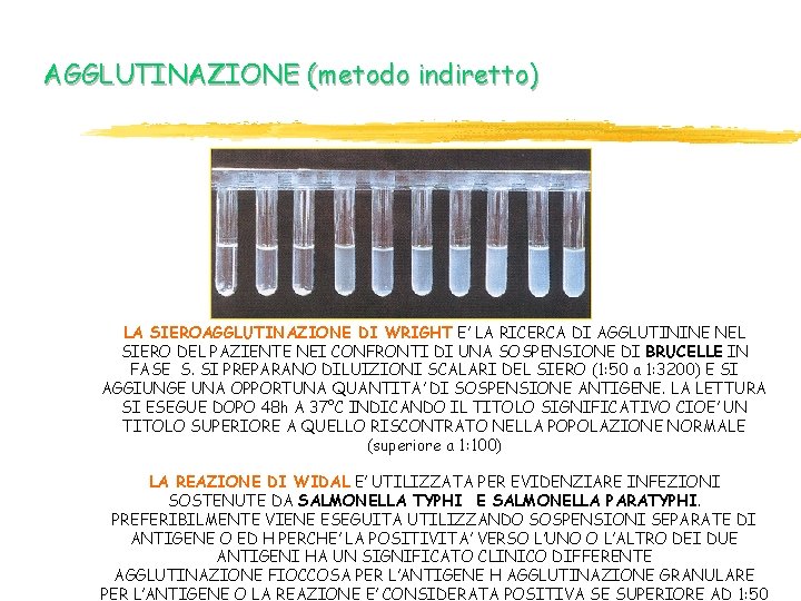 AGGLUTINAZIONE (metodo indiretto) LA SIEROAGGLUTINAZIONE DI WRIGHT E’ LA RICERCA DI AGGLUTININE NEL SIERO AGGLUTINAZIONE (metodo indiretto) LA SIEROAGGLUTINAZIONE DI WRIGHT E’ LA RICERCA DI AGGLUTININE NEL SIERO