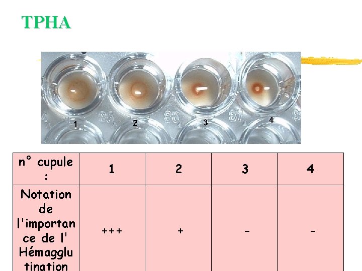TPHA n° cupule : 1 2 3 4 Notation de l'importan ce de l' TPHA n° cupule : 1 2 3 4 Notation de l'importan ce de l'
