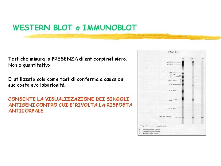 WESTERN BLOT o IMMUNOBLOT Test che misura la PRESENZA di anticorpi nel siero. Non WESTERN BLOT o IMMUNOBLOT Test che misura la PRESENZA di anticorpi nel siero. Non