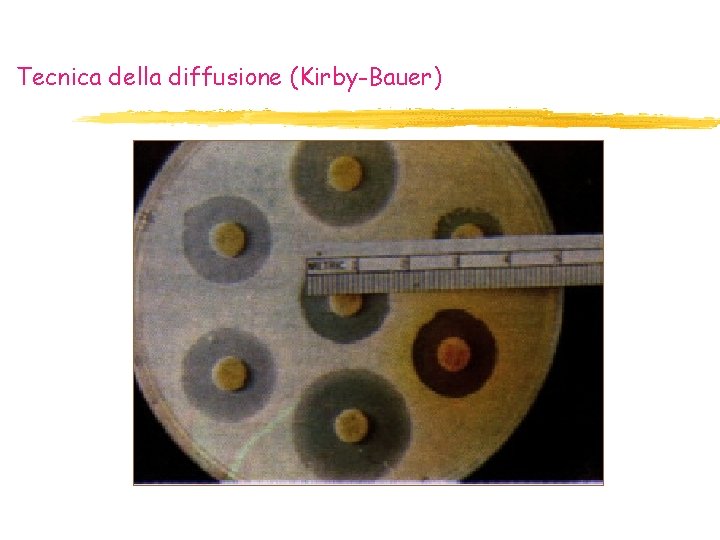 Tecnica della diffusione (Kirby-Bauer) Tecnica della diffusione (Kirby-Bauer)