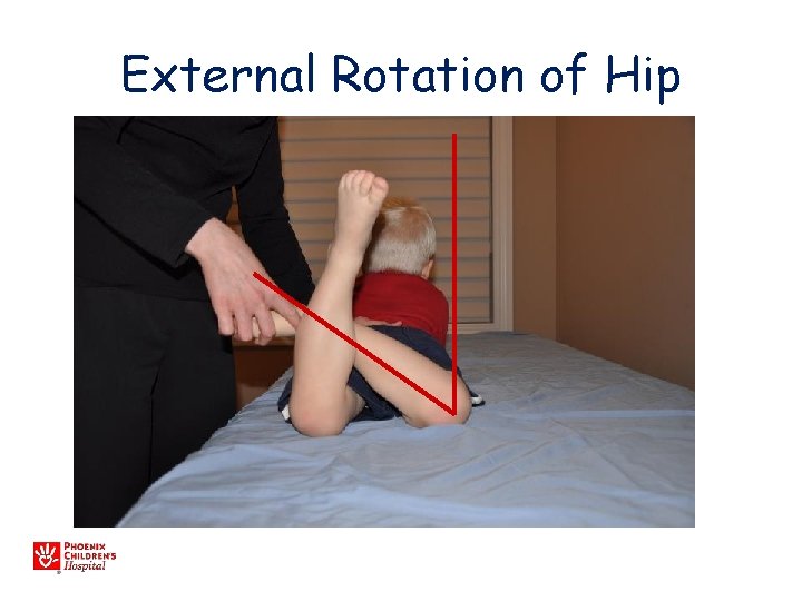 External Rotation of Hip 