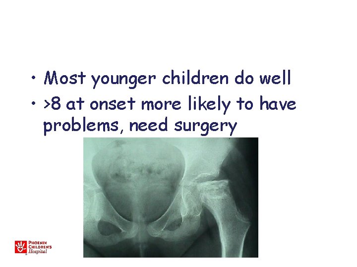  • Most younger children do well • >8 at onset more likely to