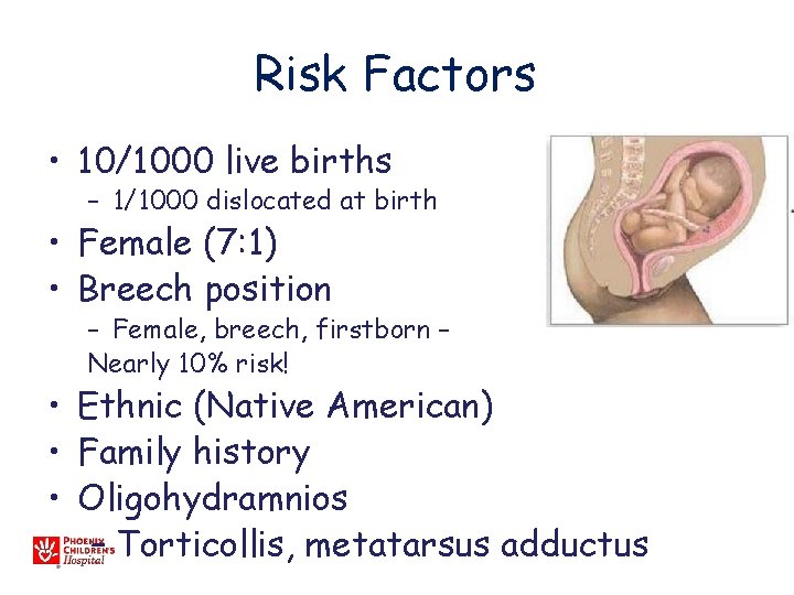 Risk Factors • 10/1000 live births – 1/1000 dislocated at birth • Female (7: