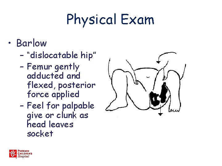 Physical Exam • Barlow – “dislocatable hip” – Femur gently adducted and flexed, posterior