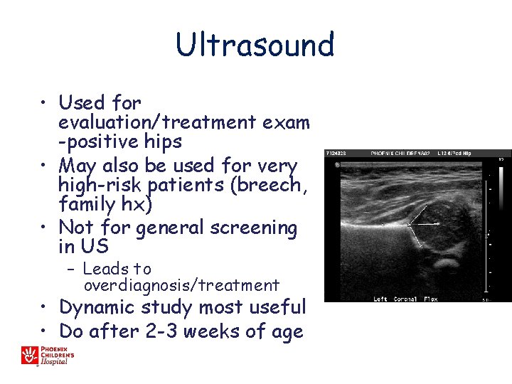 Ultrasound • Used for evaluation/treatment exam -positive hips • May also be used for