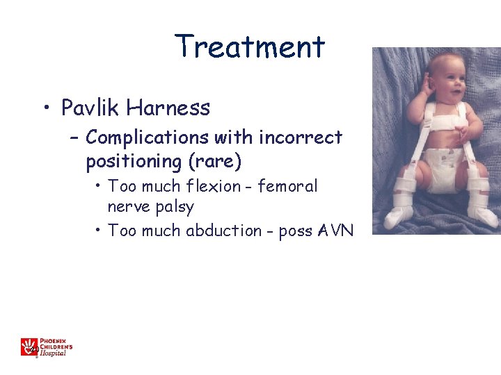 Treatment • Pavlik Harness – Complications with incorrect positioning (rare) • Too much flexion