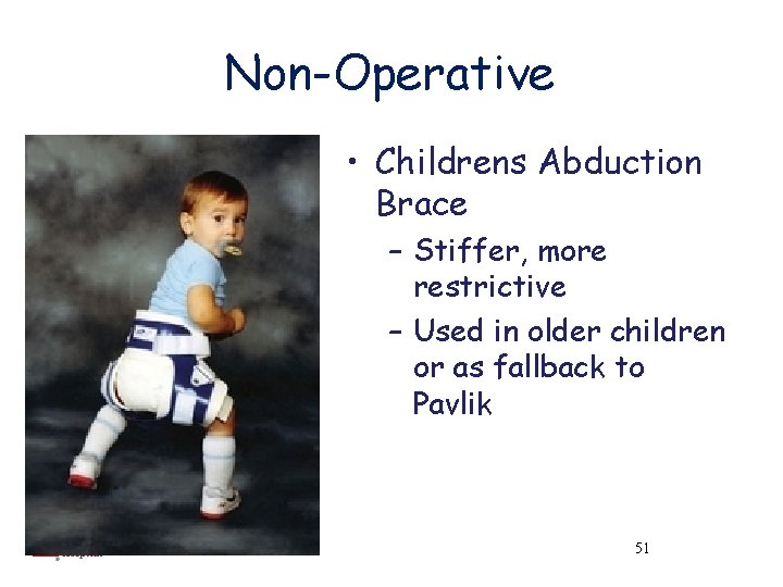 Non-Operative • Childrens Abduction Brace – Stiffer, more restrictive – Used in older children