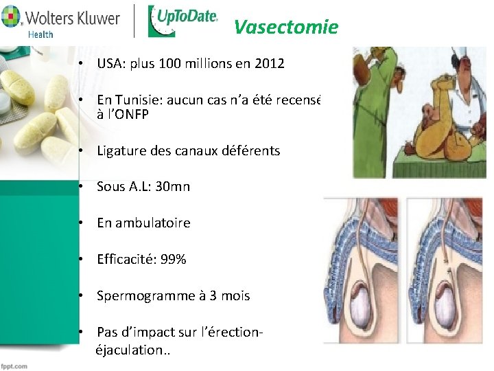 Vasectomie • USA: plus 100 millions en 2012 • En Tunisie: aucun cas n’a Vasectomie • USA: plus 100 millions en 2012 • En Tunisie: aucun cas n’a