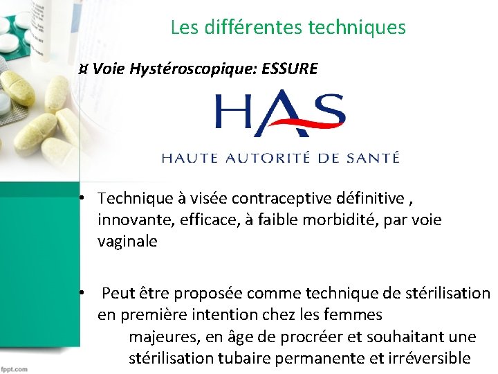 Les différentes techniques ¤ Voie Hystéroscopique: ESSURE • Technique à visée contraceptive définitive , Les différentes techniques ¤ Voie Hystéroscopique: ESSURE • Technique à visée contraceptive définitive ,