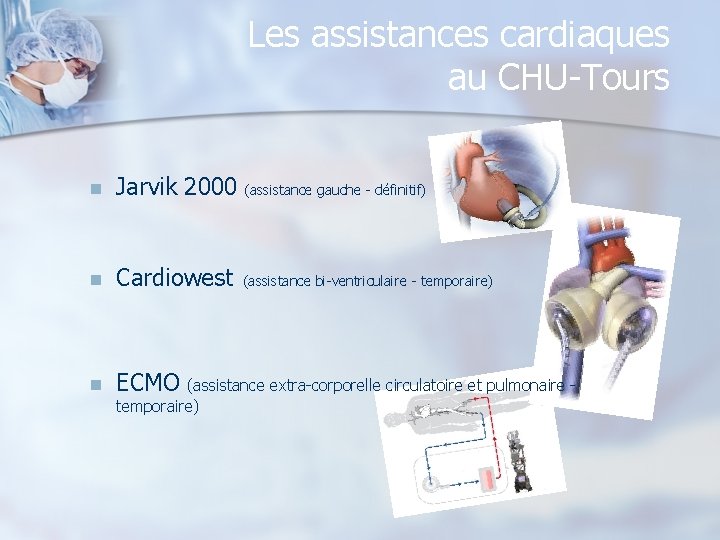 Les assistances cardiaques au CHU-Tours n Jarvik 2000 (assistance gauche - définitif) n Cardiowest