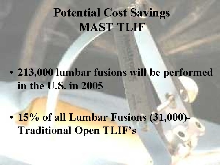 Potential Cost Savings MAST TLIF • 213, 000 lumbar fusions will be performed in