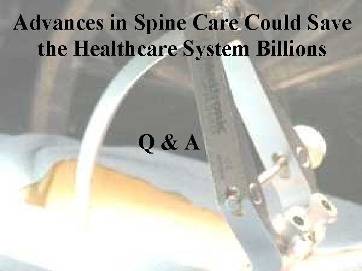 Advances in Spine Care Could Save the Healthcare System Billions Q&A 