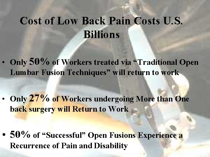 Cost of Low Back Pain Costs U. S. Billions • Only 50% of Workers
