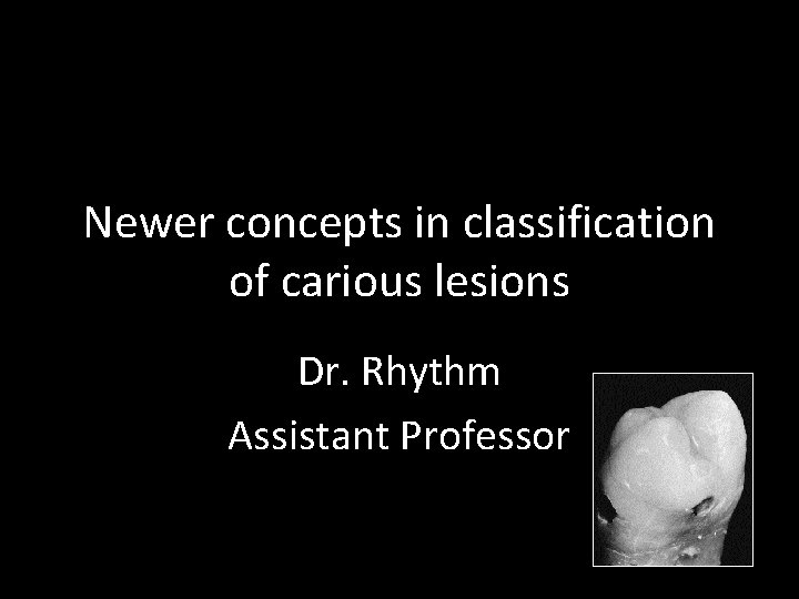 Newer concepts in classification of carious lesions Dr. Rhythm Assistant Professor 