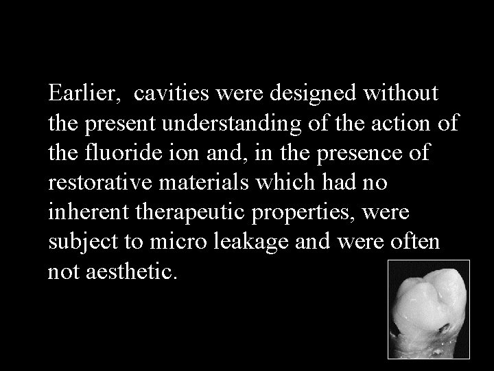Earlier, cavities were designed without the present understanding of the action of the fluoride