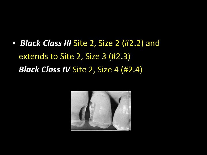  • Black Class III Site 2, Size 2 (#2. 2) and extends to