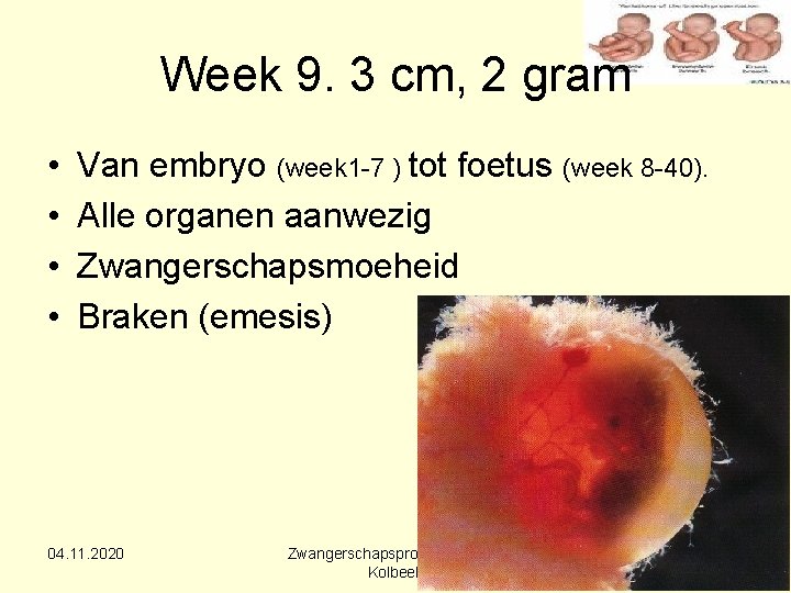 Week 9. 3 cm, 2 gram • • Van embryo (week 1 -7 )