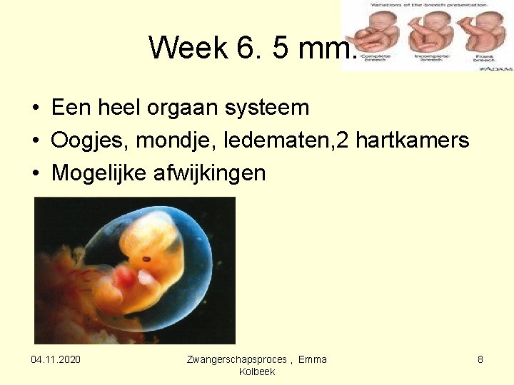 Week 6. 5 mm. • Een heel orgaan systeem • Oogjes, mondje, ledematen, 2