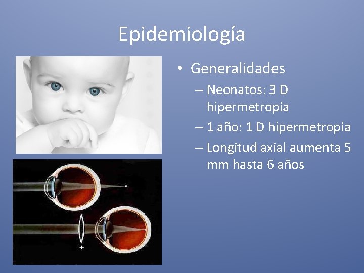 Epidemiología • Generalidades – Neonatos: 3 D hipermetropía – 1 año: 1 D hipermetropía