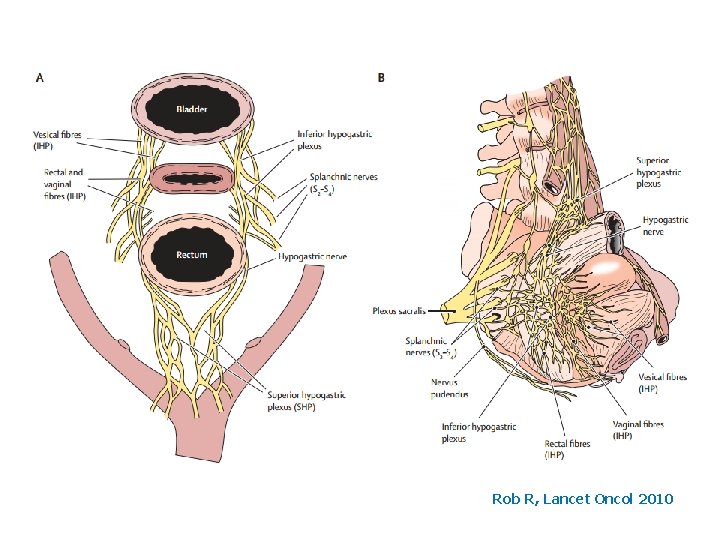 Rob R, Lancet Oncol 2010 