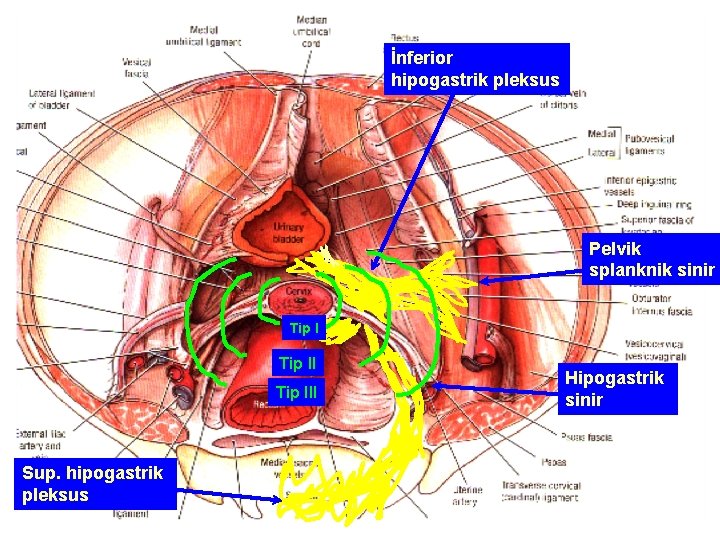İnferior hipogastrik pleksus Pelvik splanknik sinir Tip III Sup. hipogastrik pleksus Hipogastrik sinir 