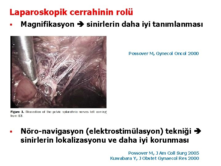Laparoskopik cerrahinin rolü § Magnifikasyon sinirlerin daha iyi tanımlanması Possover M, Gynecol Oncol 2000
