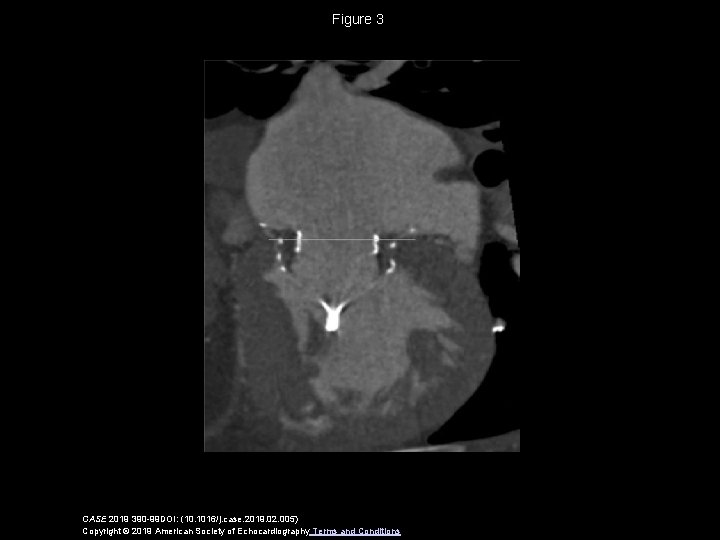 Figure 3 CASE 2019 390 -99 DOI: (10. 1016/j. case. 2019. 02. 005) Copyright