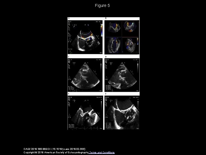 Figure 5 CASE 2019 390 -99 DOI: (10. 1016/j. case. 2019. 02. 005) Copyright