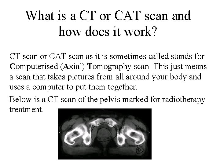 What is a CT or CAT scan and how does it work? CT scan