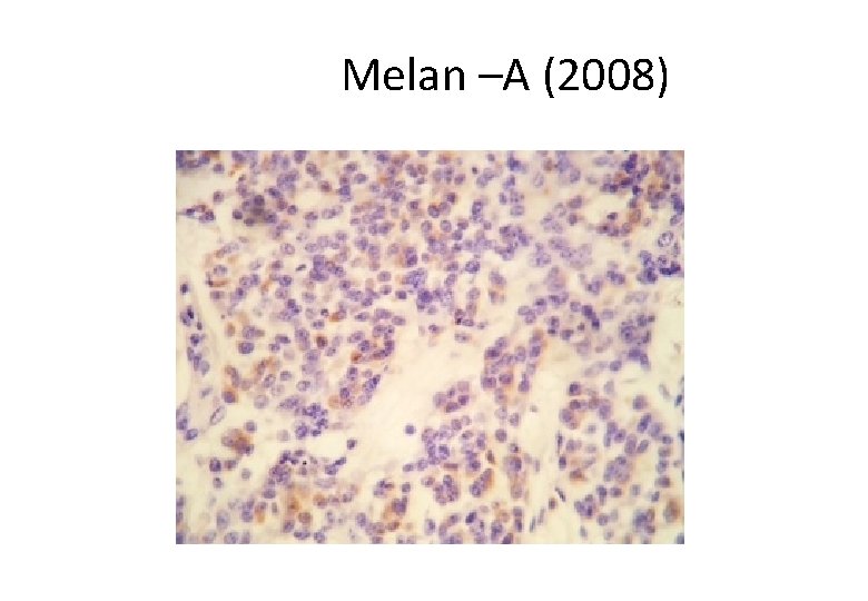  Melan –A (2008) 