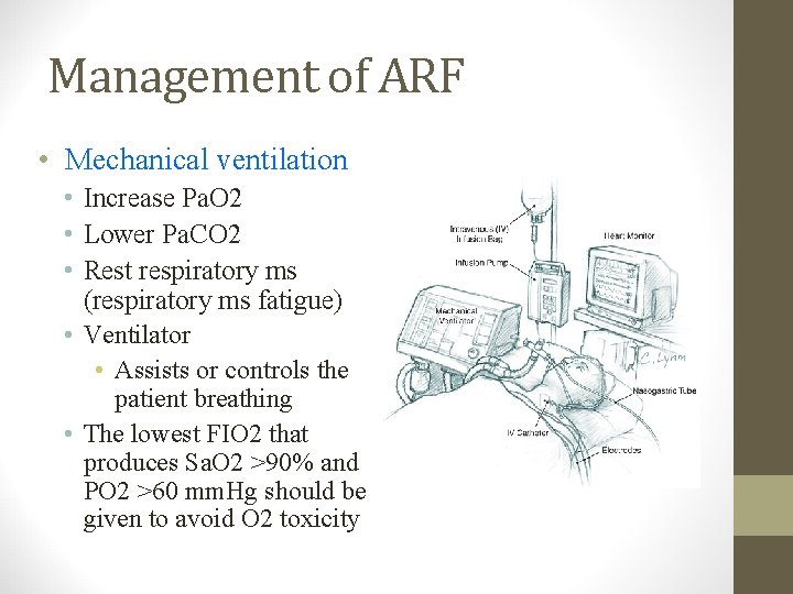 Management of ARF • Mechanical ventilation • Increase Pa. O 2 • Lower Pa.