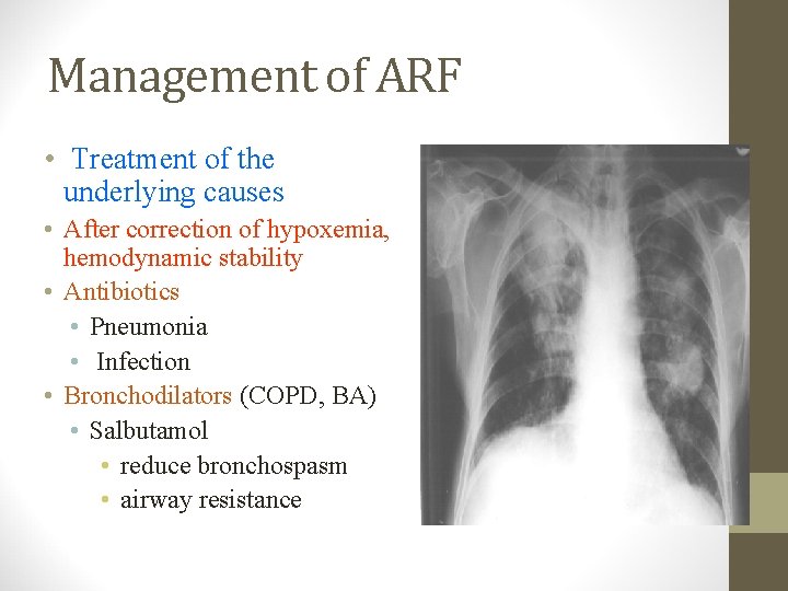 Management of ARF • Treatment of the underlying causes • After correction of hypoxemia,