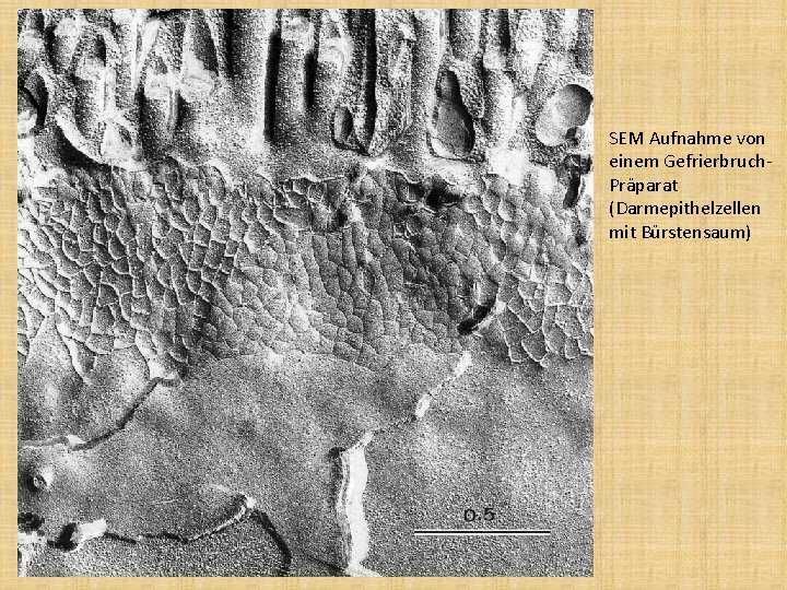 SEM Aufnahme von einem Gefrierbruch. Präparat (Darmepithelzellen mit Bürstensaum) 