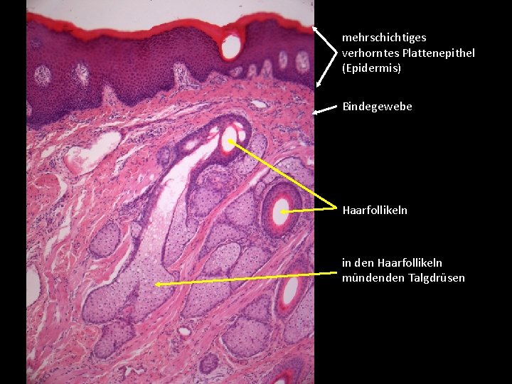 mehrschichtiges verhorntes Plattenepithel (Epidermis) Bindegewebe Haarfollikeln in den Haarfollikeln mündenden Talgdrüsen 