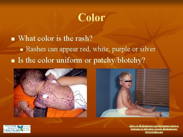 Color n What color is the rash? n n Rashes can appear red, white,