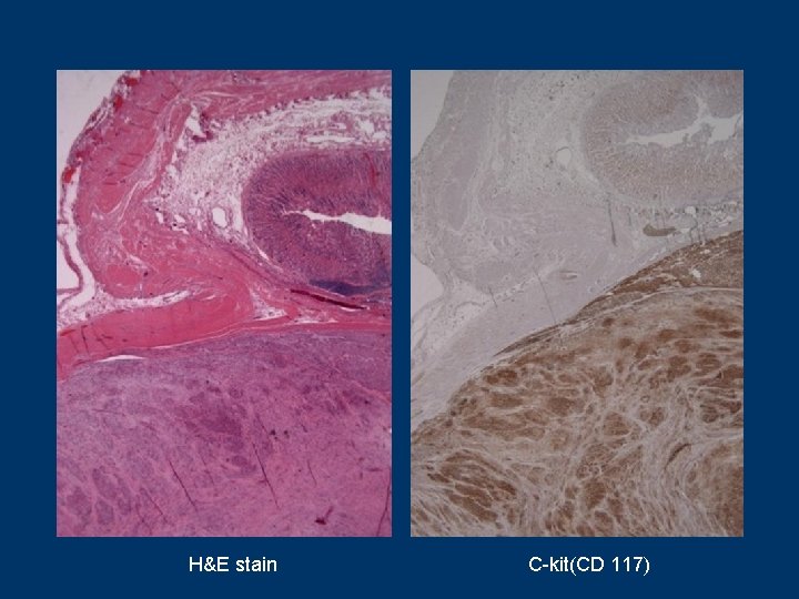 H&E stain C-kit(CD 117) 