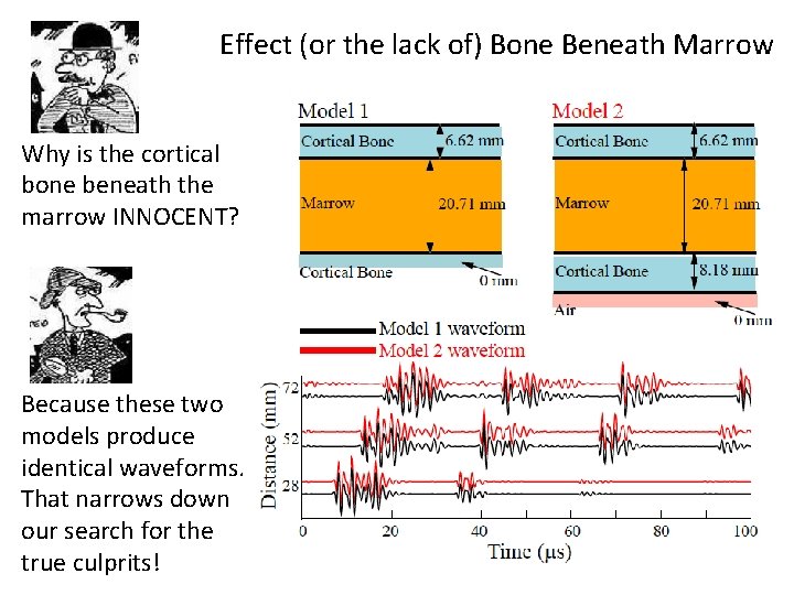 Effect (or the lack of) Bone Beneath Marrow Why is the cortical bone beneath