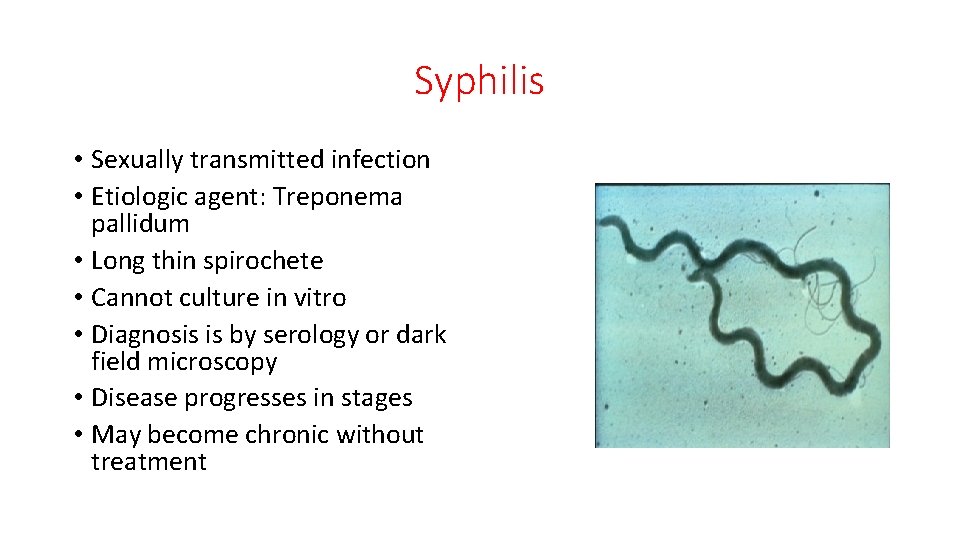 Syphilis • Sexually transmitted infection • Etiologic agent: Treponema pallidum • Long thin spirochete