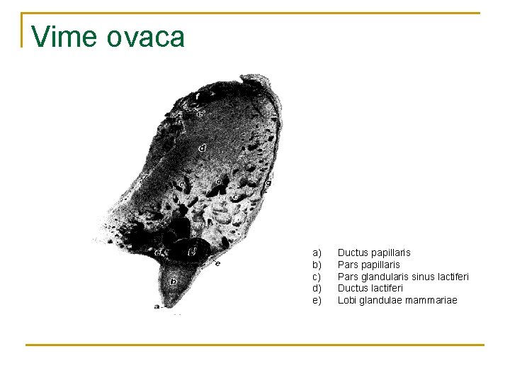 Vime ovaca a) b) c) d) e) Ductus papillaris Pars glandularis sinus lactiferi Ductus