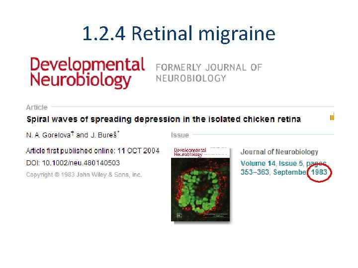 1. 2. 4 Retinal migraine A. At least 2 attacks fulfilling criteria B and