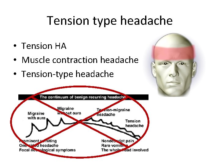 Tension type headache • Tension HA • Muscle contraction headache • Tension-type headache 