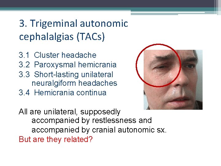 3. Trigeminal autonomic cephalalgias (TACs) 3. 1 Cluster headache 3. 2 Paroxysmal hemicrania 3.