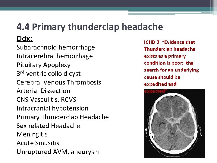 4. 4 Primary thunderclap headache Ddx: Subarachnoid hemorrhage Intracerebral hemorrhage Pituitary Apoplexy 3 rd