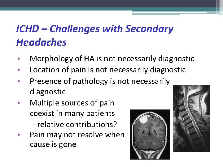 ICHD – Challenges with Secondary Headaches Morphology of HA is not necessarily diagnostic Location