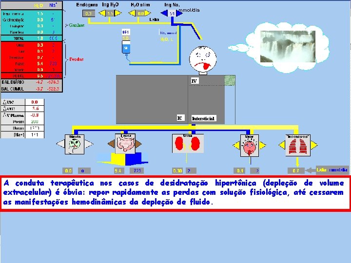 , mmol/dia IV IC Intersticial A conduta terapêutica nos casos de desidratação hipertônica (depleção