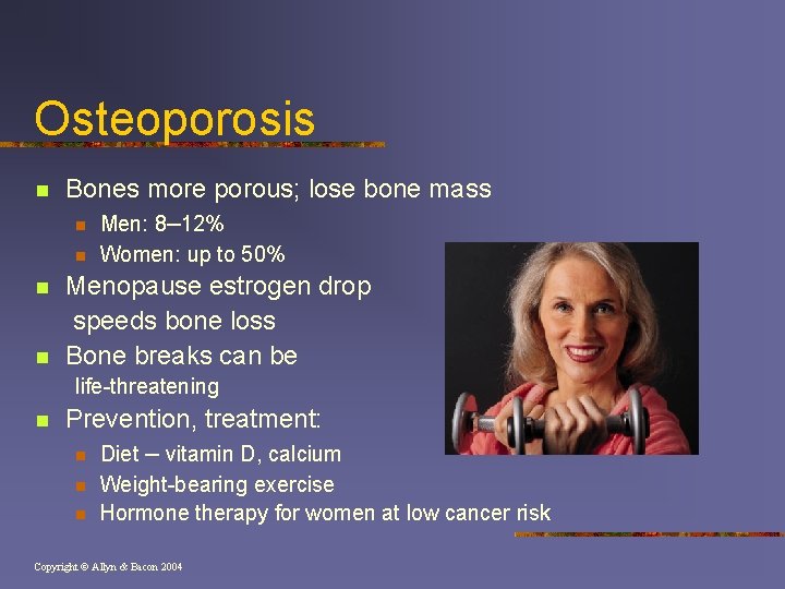 Osteoporosis n Bones more porous; lose bone mass n Men: 8– 12% n n