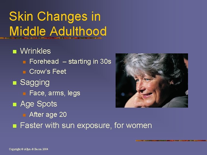 Skin Changes in Middle Adulthood n Wrinkles n n n Sagging n n Face,