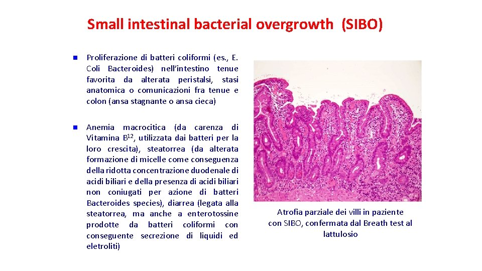 Small intestinal bacterial overgrowth (SIBO) n Proliferazione di batteri coliformi (es. , E. Coli