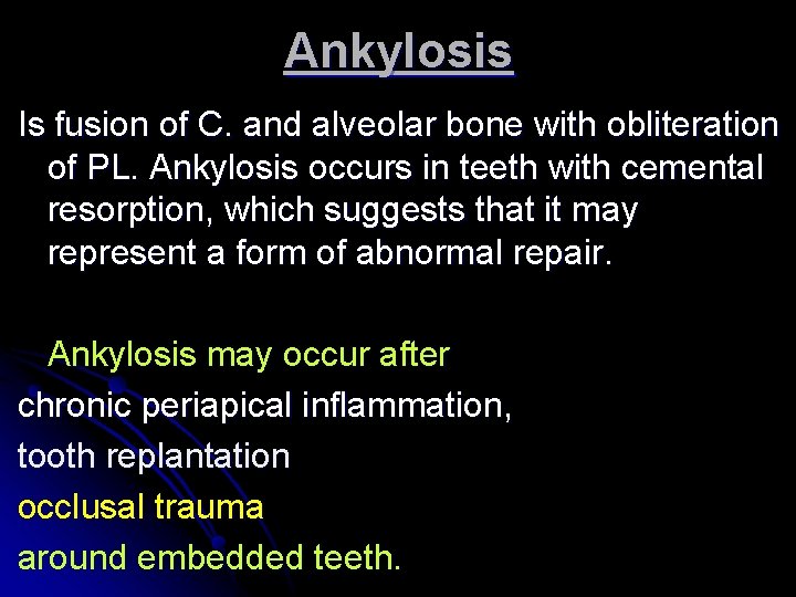 Ankylosis Is fusion of C. and alveolar bone with obliteration of PL. Ankylosis occurs