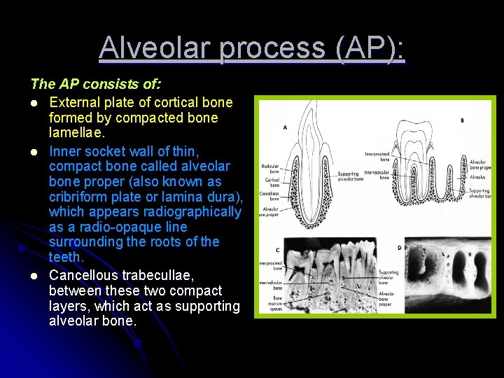 Alveolar process (AP): The AP consists of: l External plate of cortical bone formed